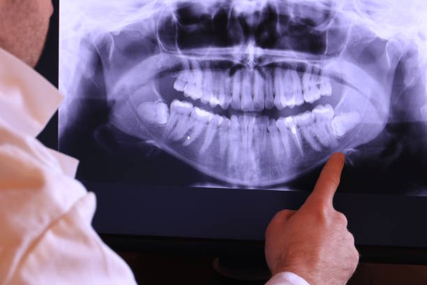 Best Emergency Dental Surgery in North Vacherie, LA